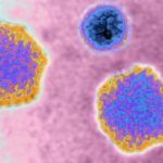 hepatitis-ausbruch:-alabama-faelle-im-zusammenhang-mit-haeufigem-virus-koennen-hinweise-liefern